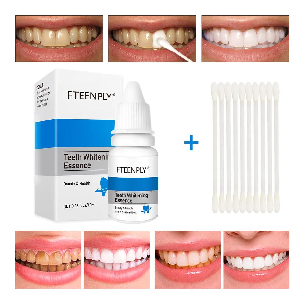 FTEENPLY Teeth Whitening Essen - Teeth Whitening Near Me 评论和价格