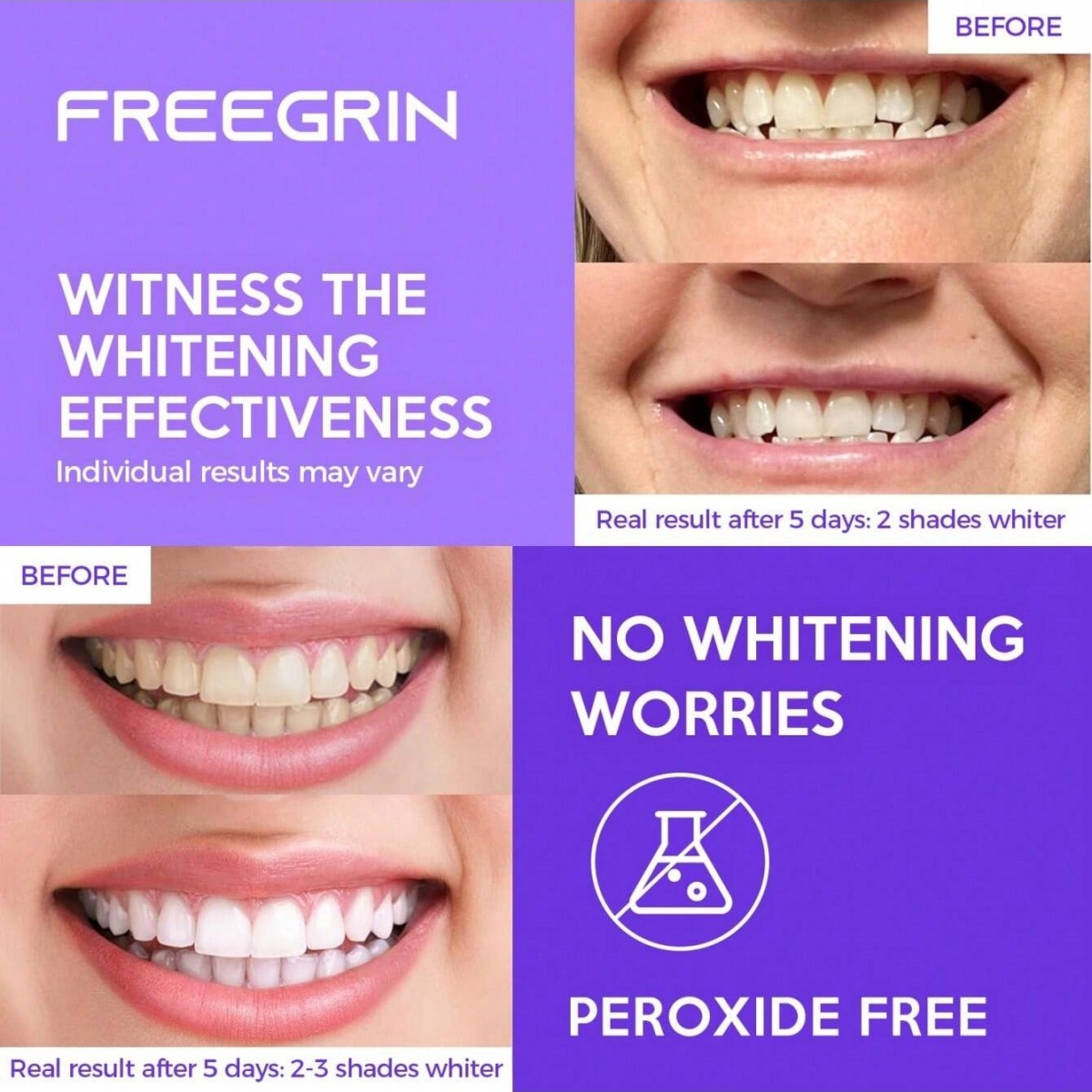 Deluxe Whitening Teeth Sticker - Teeth Whitening Near Me 评论和价格
