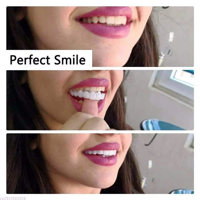 Snap-on Veneer Teeth Kit Adjus - Teeth Whitening Kit 评论和价格